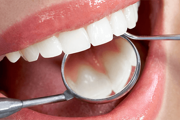 periodontia-02